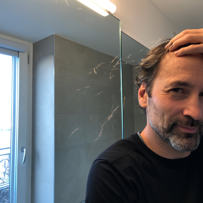 8 . Thinning Hair and Softening Jawline